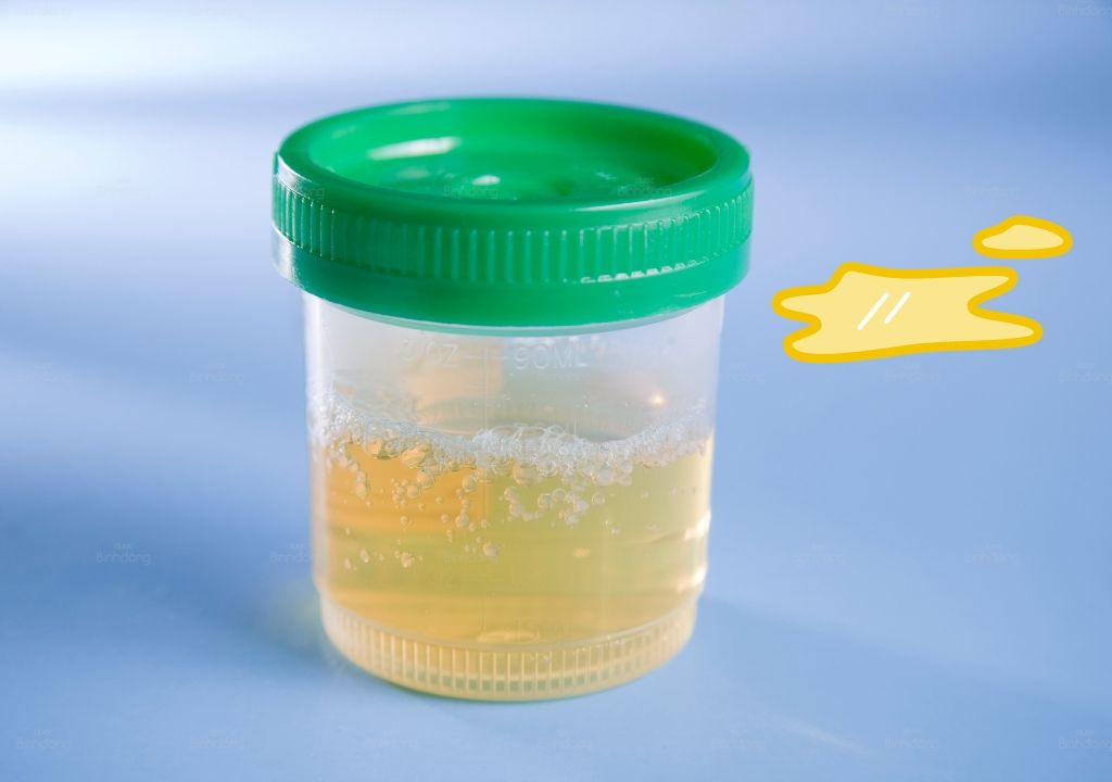 nuoc-tieu-co-vang.jpg